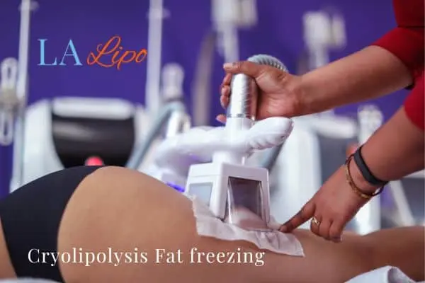 women getting fat freezing Darlington