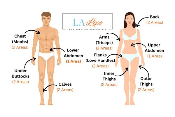 LA LIPO Cryolipolysis Areas Darlington