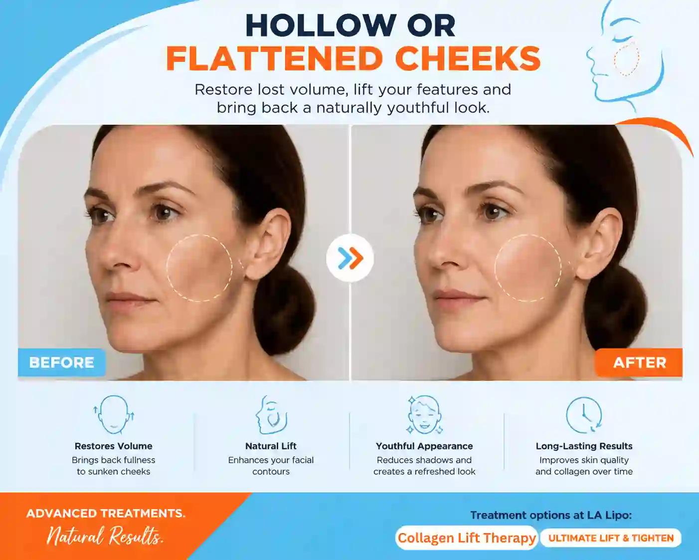 Sign #4: Hollow or Flattened Cheeks Darlington