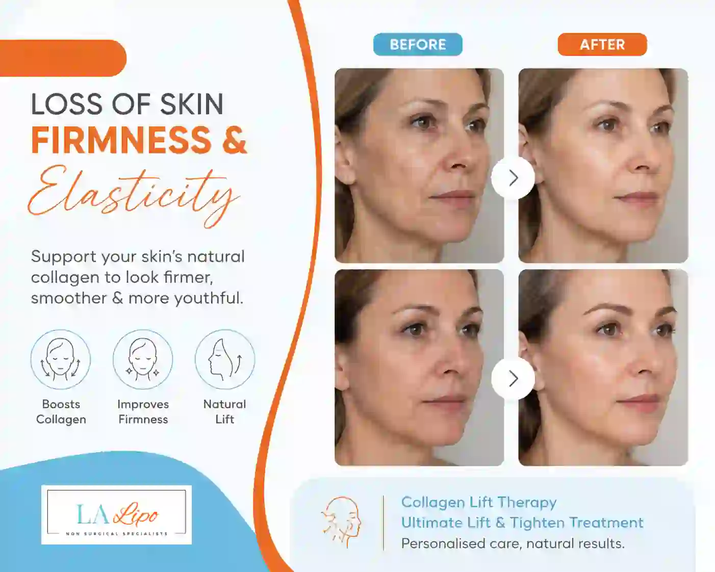 Sign #7: Loss of Skin Firmness and Elasticity Darlington